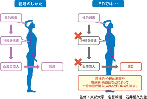 勃起 しにくい|勃起不全（ED）の原因とは？治療や予防方法についても解説！